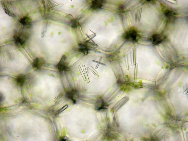 calcium oxalate crystal