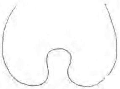 hippocrepiform