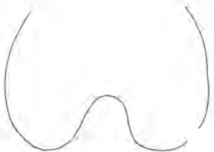 parabolic