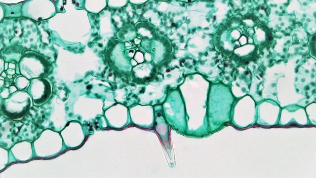 trichome