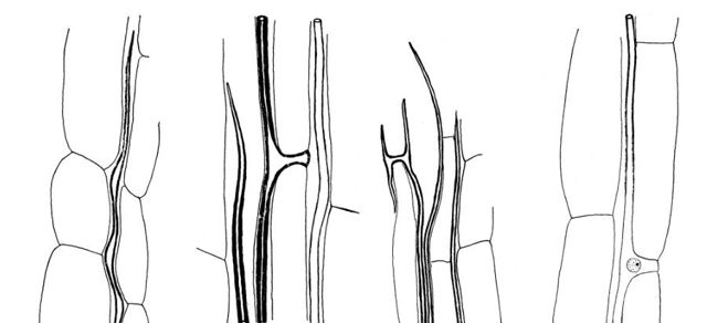 trichosclereid